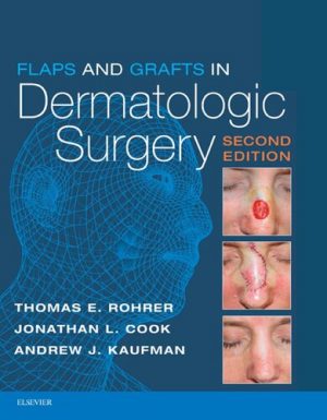 Flaps and Grafts in Dermatologic Surgery