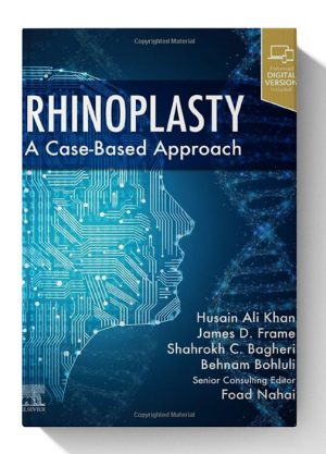 Rhinoplasty a Case based approach 1st Ed 2022 edition