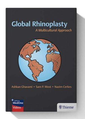 Global Rhinoplasty A Multicultural Approach 1st Edition 1