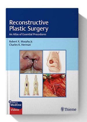 Reconstructive Plastic Surgery An Atlas of Essential Procedures 1st Edition 1