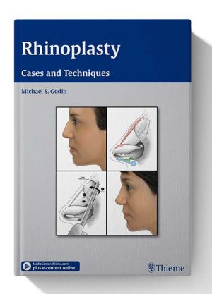 Rhinoplasty Cases and Techniques 1