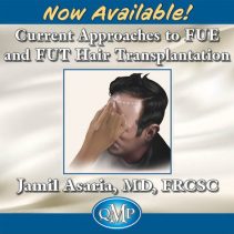 Current Approaches to FUE and FUT Hair Transplantation