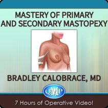 Mastery of Primary and Secondary Mastopexy e1715197194378