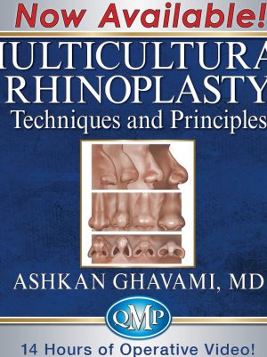 QMP Multicultural Rhinoplasty - Techniques and Principles