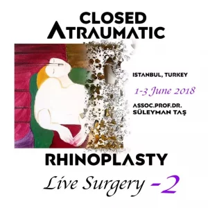 Closed Atraumatic Rhinoplasty Live Surgery DVD 2 2018