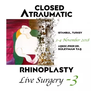 Closed Atraumatic Rhinoplasty Live Surgery DVD 3 2018