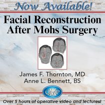 Facial Reconstruction After Mohs Surgery